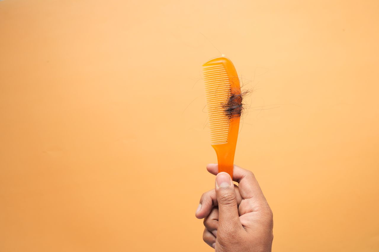 perte de cheveux femme